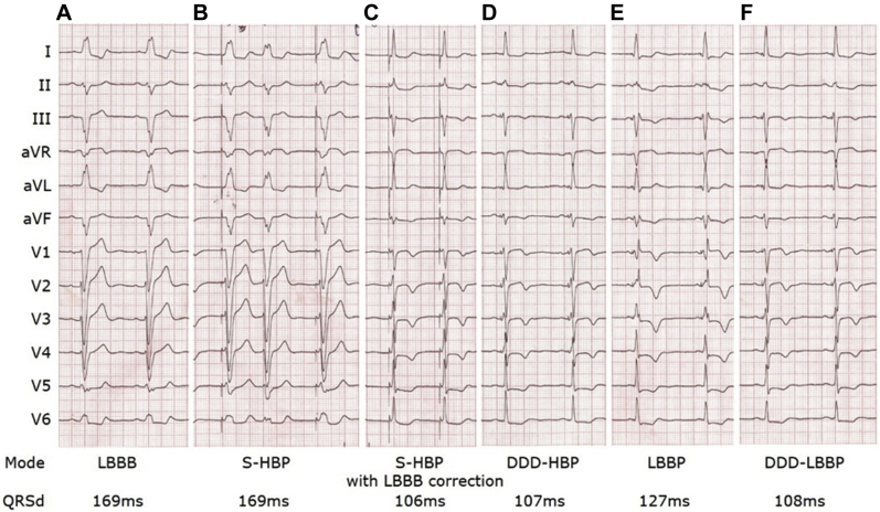 Figure 2