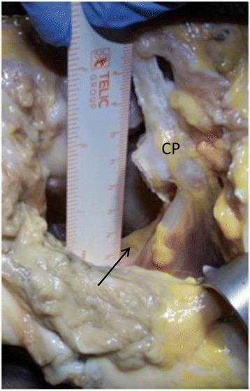 Fig. 11