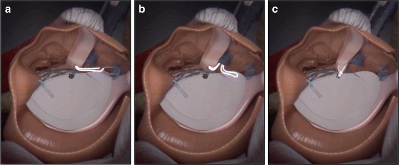 Fig. 8