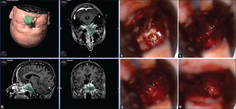 Figure 4