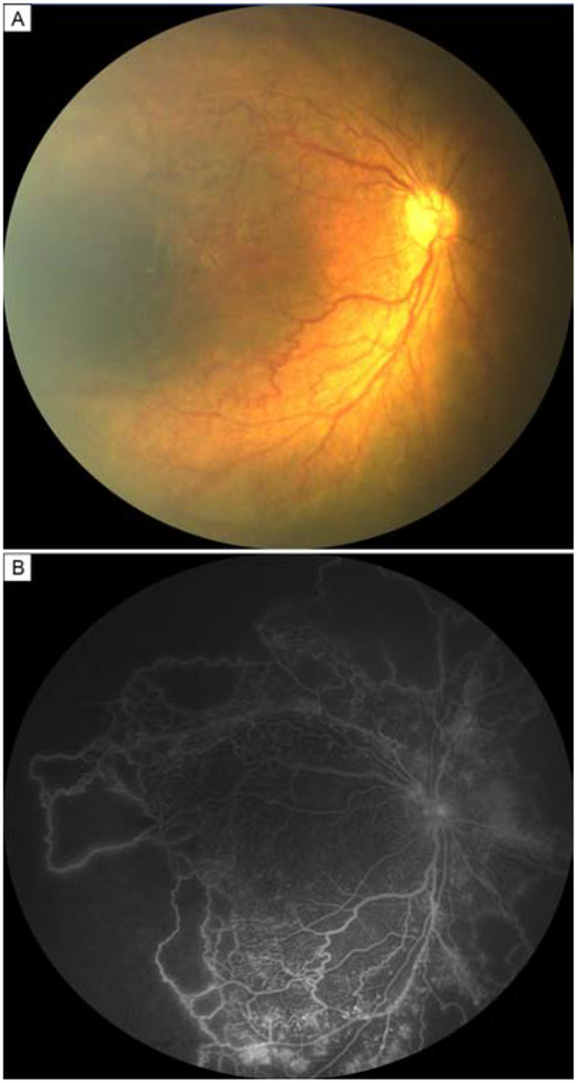 FIG 1.