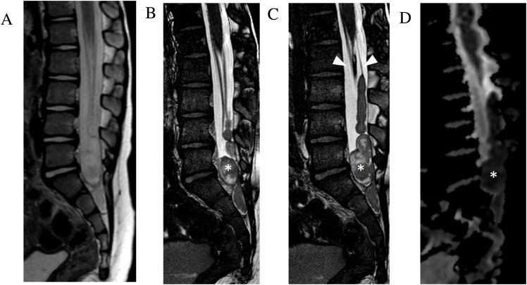 Fig. 13