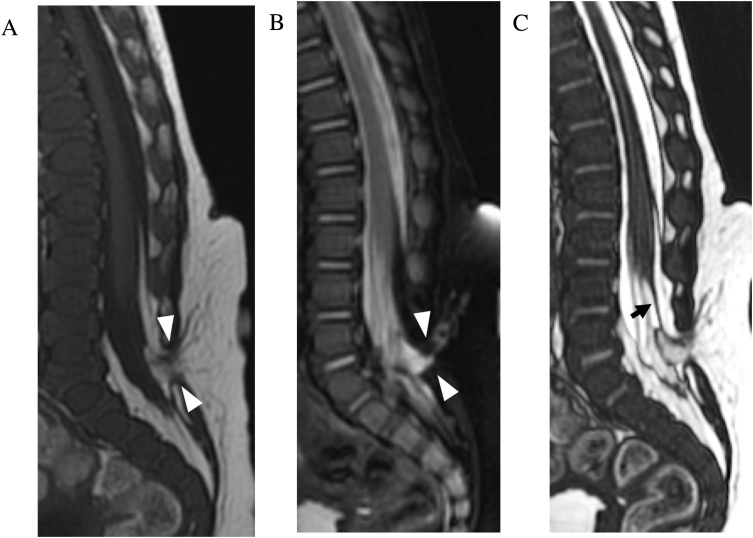 Fig. 14