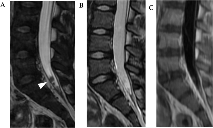 Fig. 12