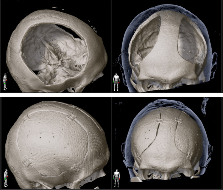 Fig. 6