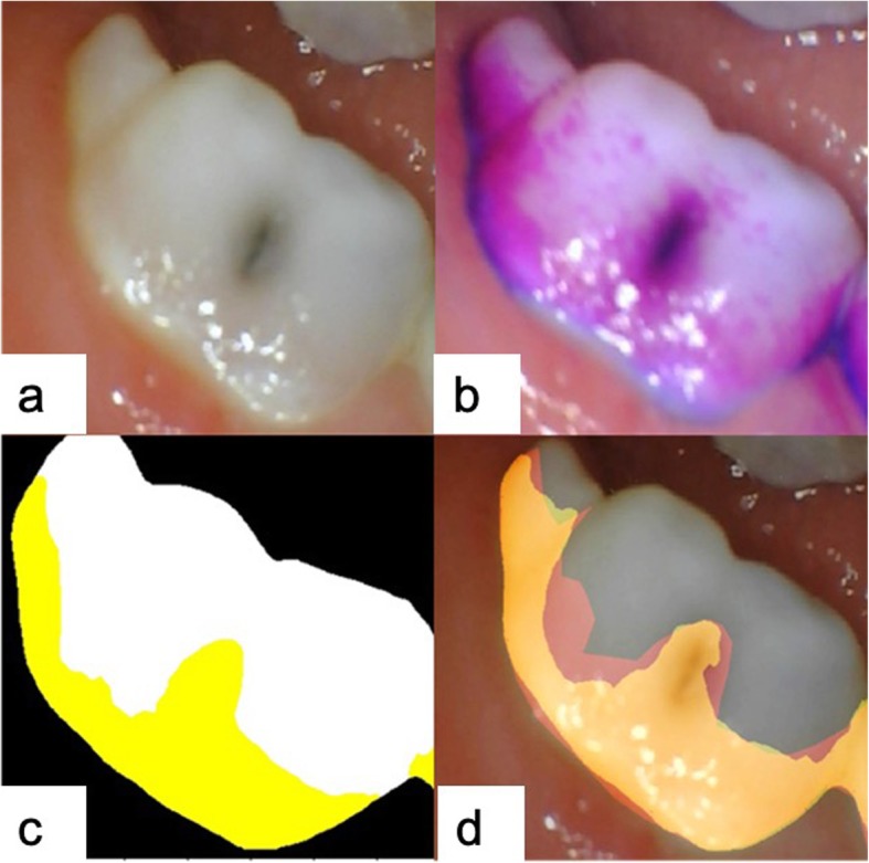 Fig. 3