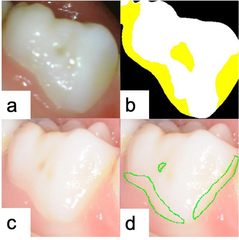 Fig. 4