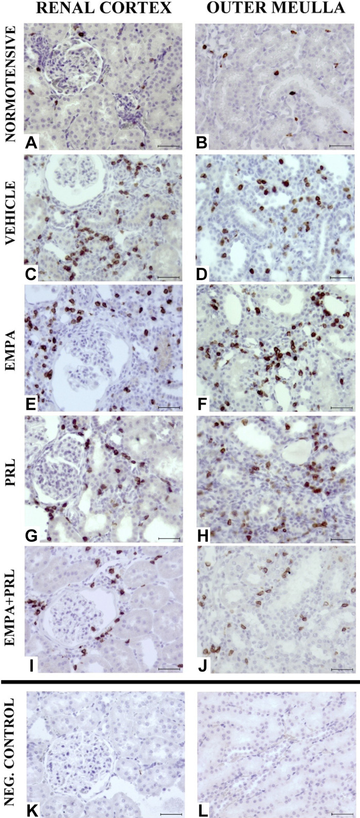 Figure 11.