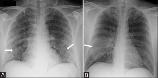 Figure 2 (A and B)