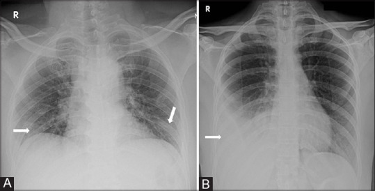 Figure 5 (A and B)