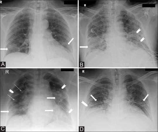 Figure 1 (A-D)