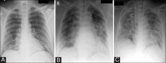 Figure 4 (A-C)