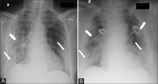 Figure 3 (A and B)