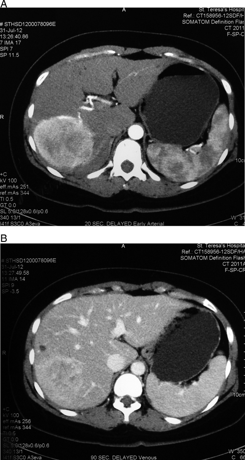 Figure 1