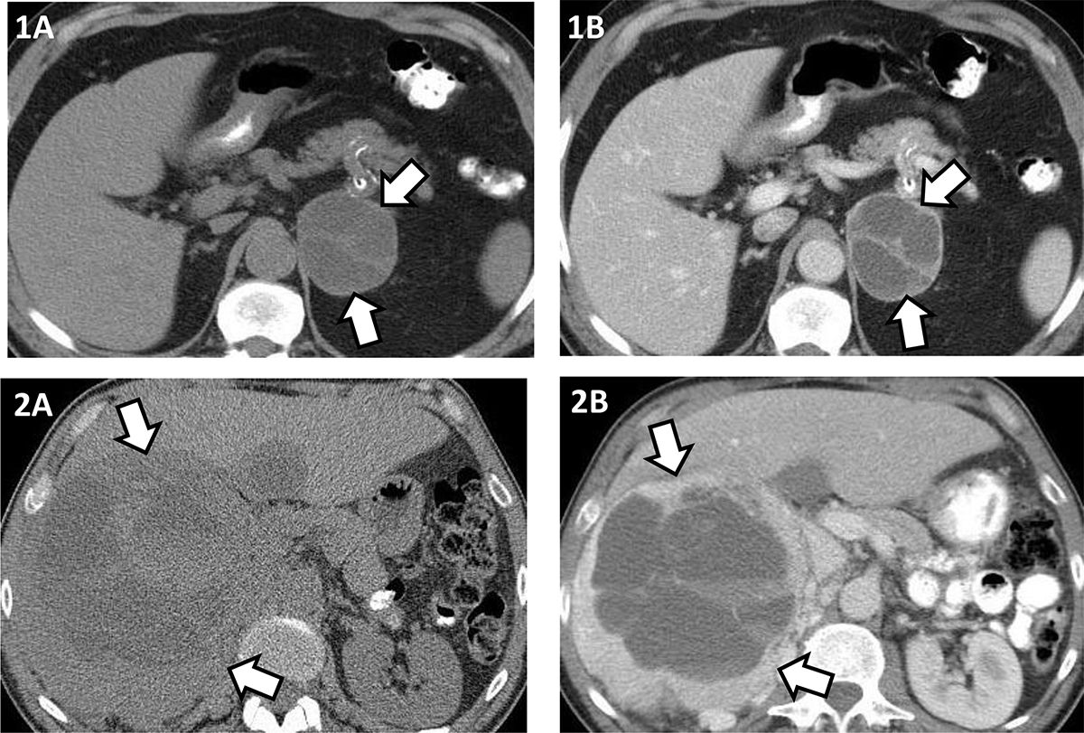 Figure 2: