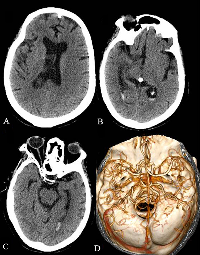 FIGURE 2