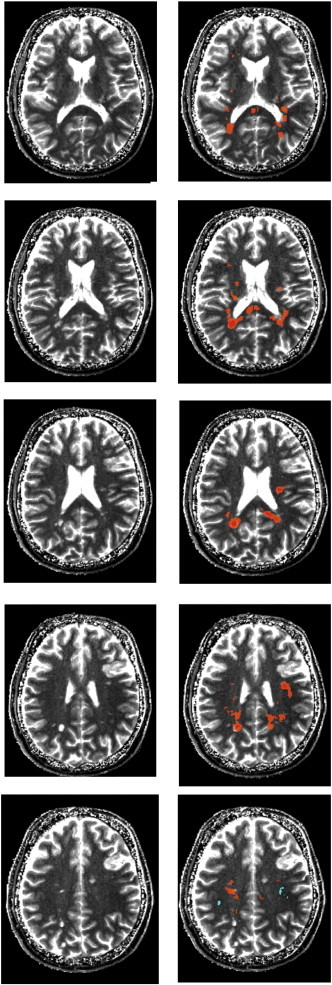 Fig. 6