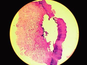 Fig. 13.5