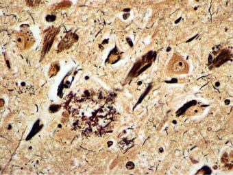 Fig. 13.9