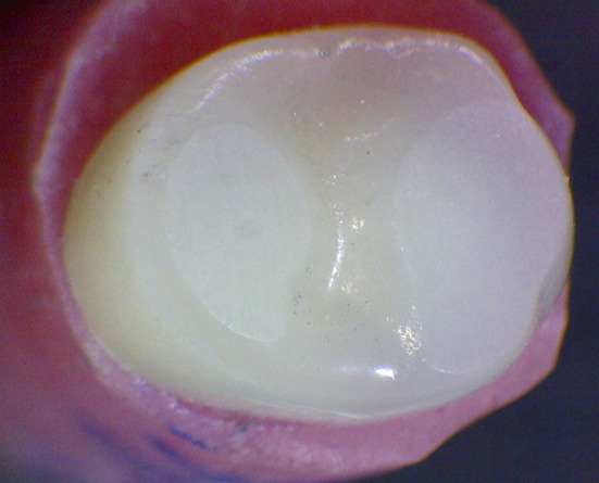 Fig. 6