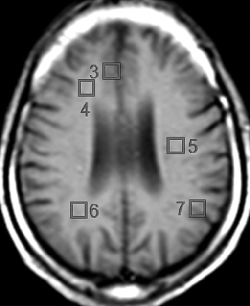 Figure 2c: