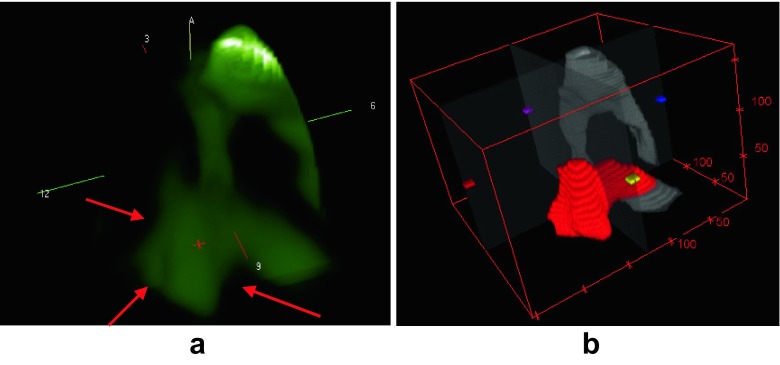 Fig. 15