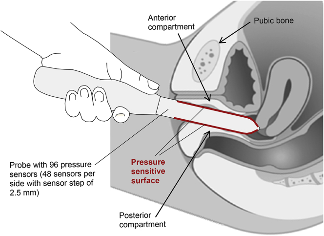 Figure 1