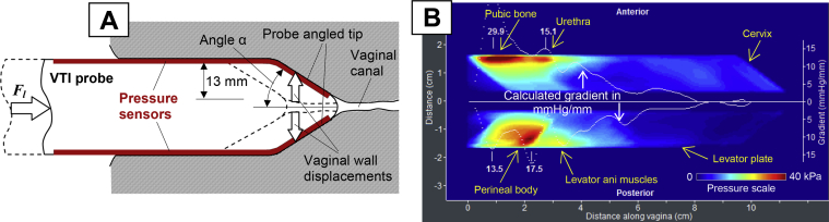 Figure 2