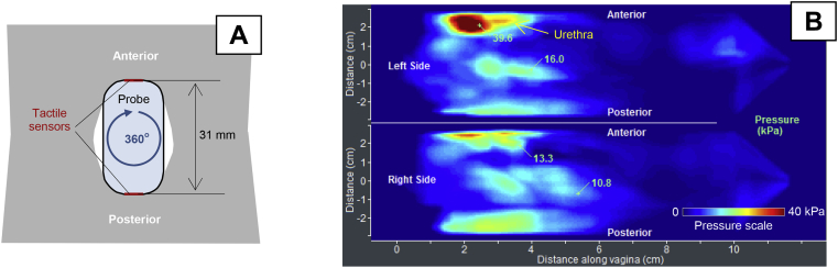 Figure 4