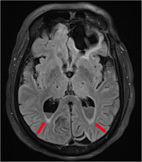 Fig. 5