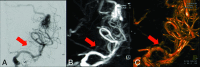 Fig 5.