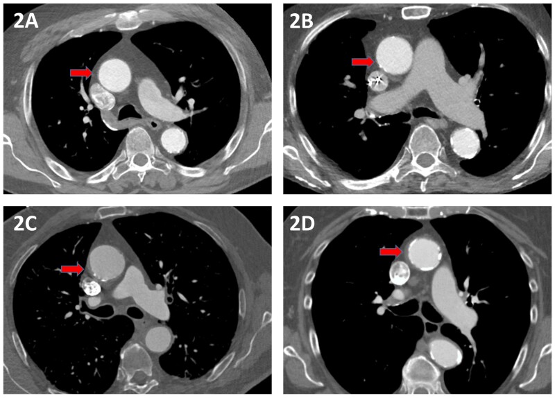 Figure 2: