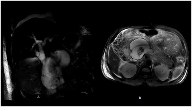 [Table/Fig-9]: