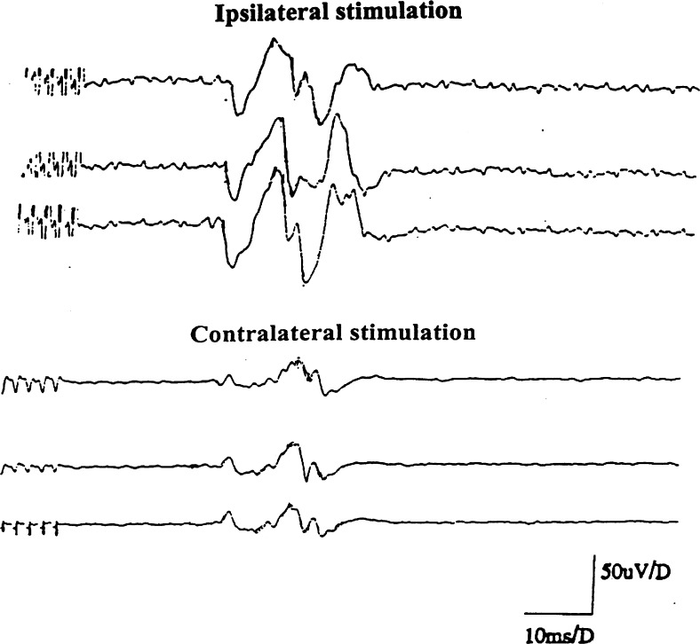 Fig. 2