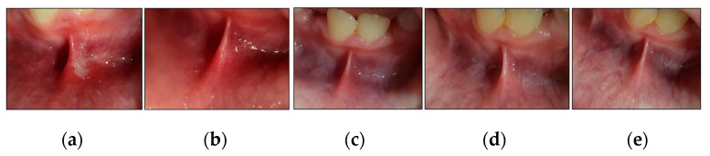 Figure 12