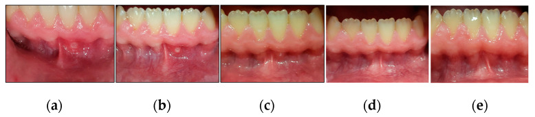 Figure 11