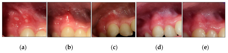 Figure 10