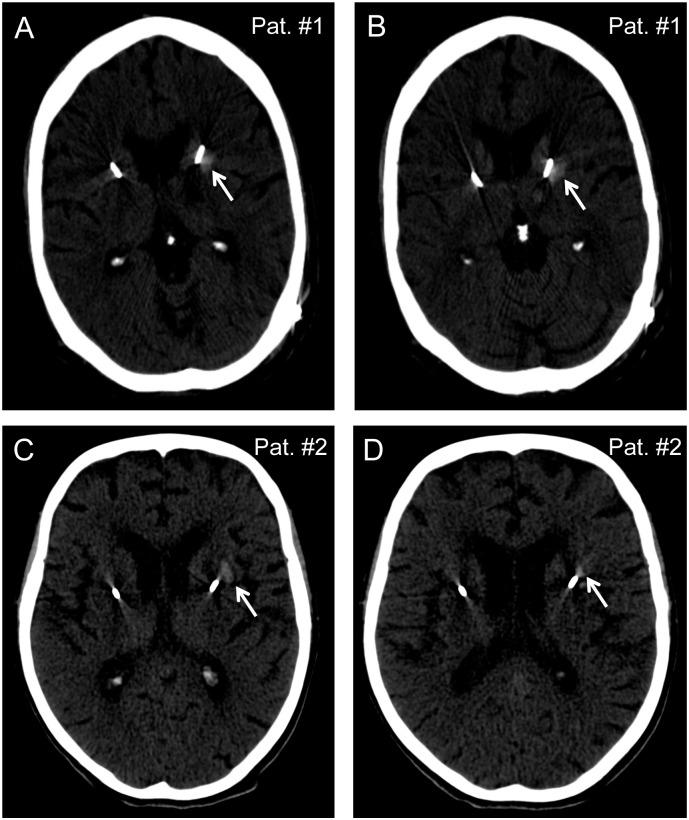 Fig 1