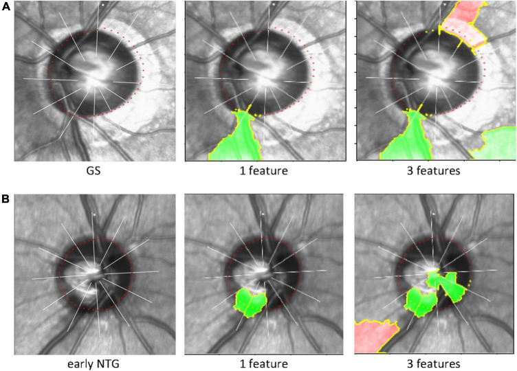 FIGURE 4