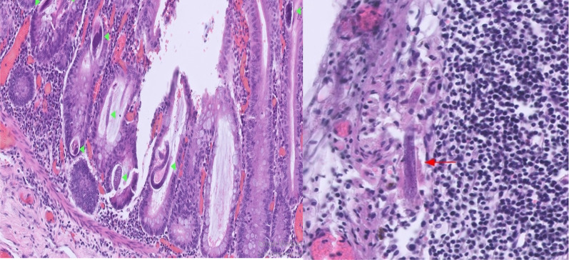 Fig. 3