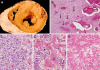 Fig. 2