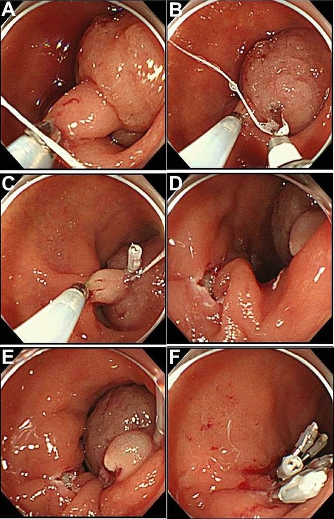 Figure 2