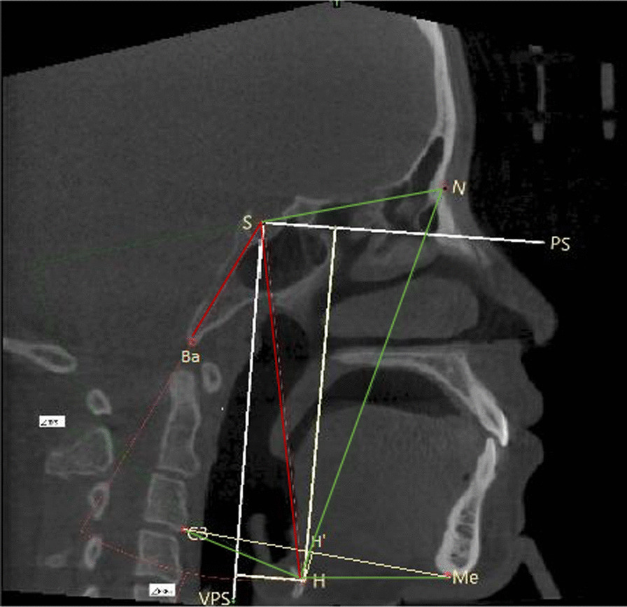 Fig. 2
