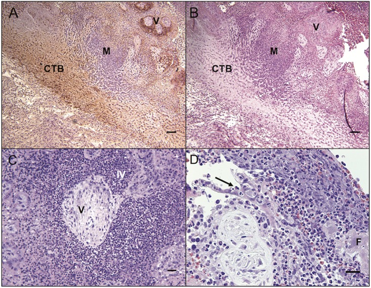 FIG 4 