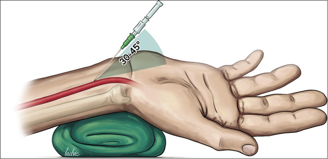 Figure 4: