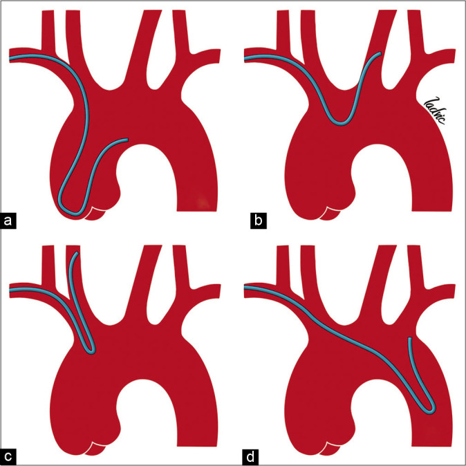 Figure 6: