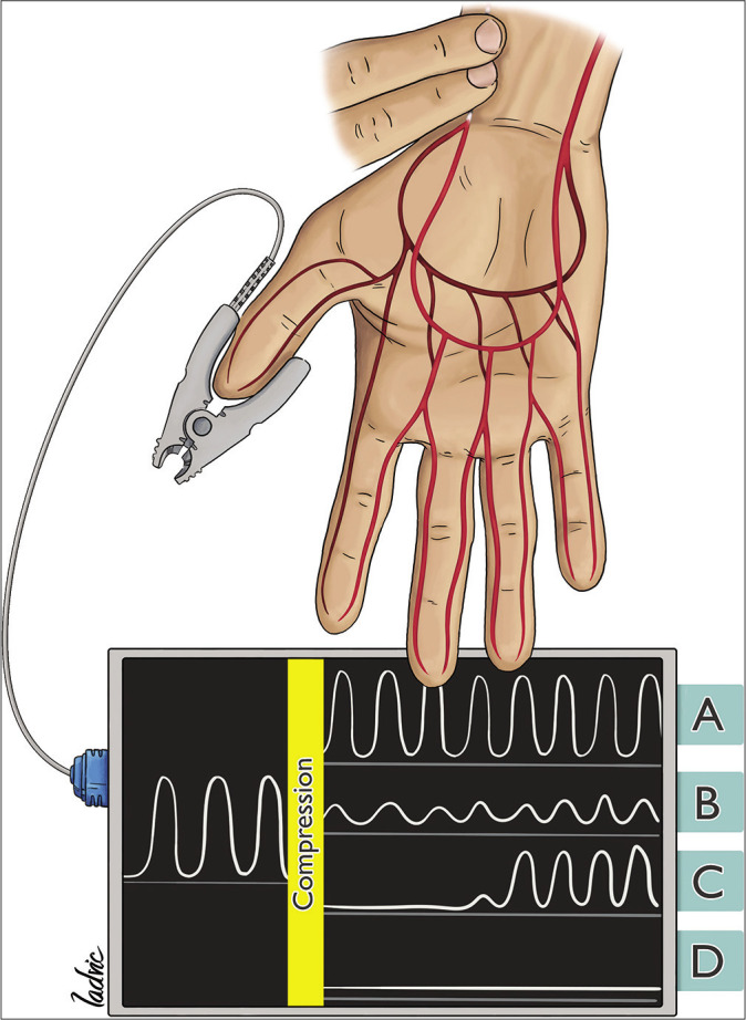 Figure 2: