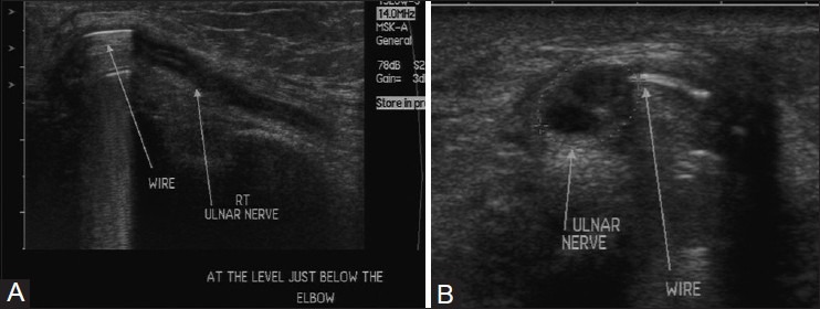 Figure 3 (A and B)