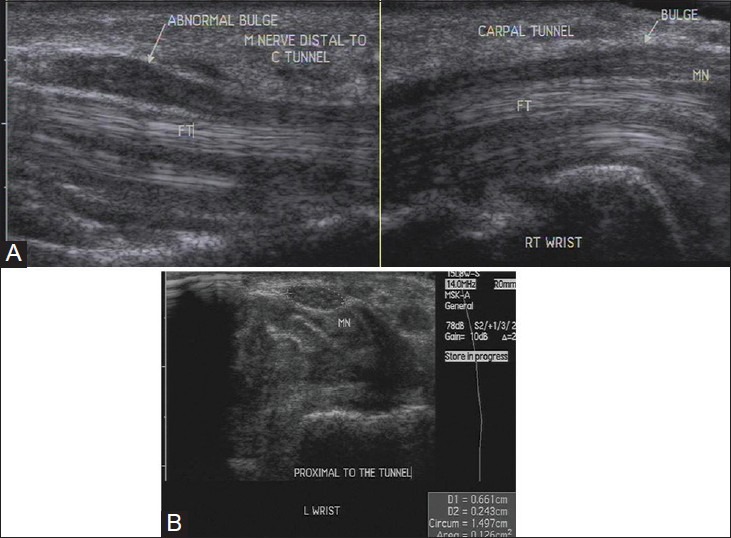 Figure 11 (A and B)