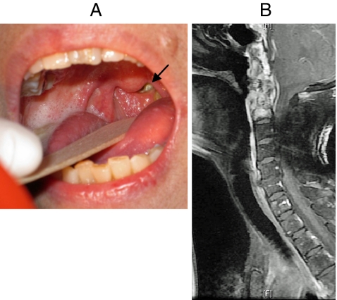 Fig. 1